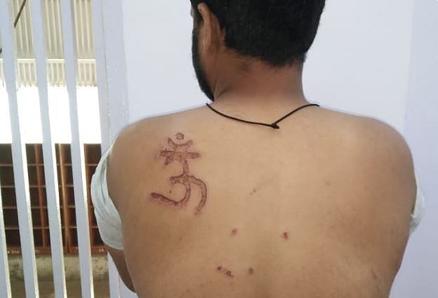 تہاڑ جیل میں حیوانیت، مسلم قیدی کا الزام، جیلر نے کمر پر گودا ’اوم‘