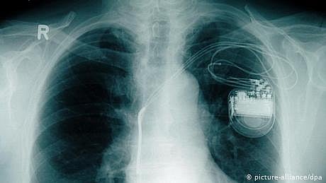 دل کے مریضوں کے لیے نئی امید: بیٹری کے بغیر پہلا پیس میکر