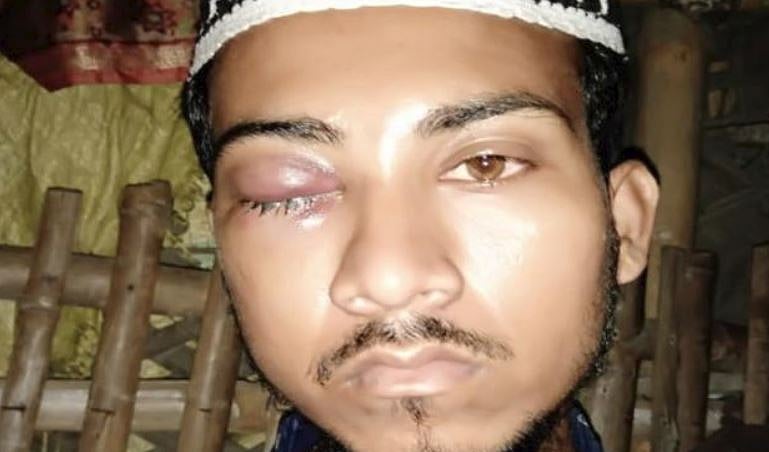 ’جے شری رام‘ کا نعرہ نہیں لگانے پر ظلم کا شکار مسلمانوں کو ممتا بنرجی دیں گی معاوضہ