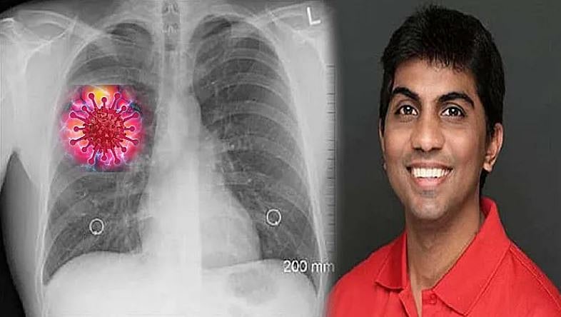 کورونا انفیکشن کی تشخیص چند سیکنڈ میں کرنے والا سافٹ ویئر تیار