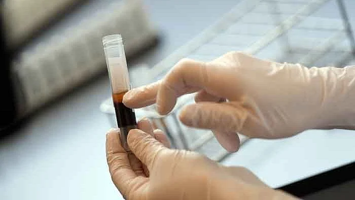 تصویر سوشل میڈیا