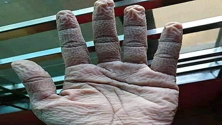 تصویر سوشل میڈیا