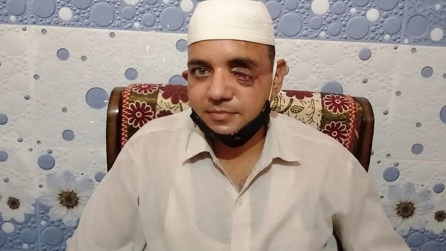 دہلی فساد میں اپنی آنکھ گنوا دینے والے محمد ناصر / تصویر محمد تسلیم