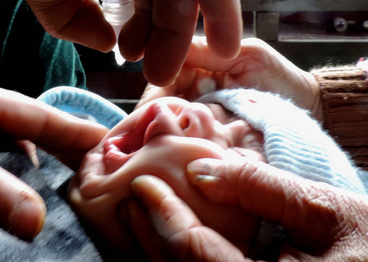 پولیو ڈراپ کی جگہ منھ میں ڈال دیا دو بوند سینیٹائزر، 12 بچوں کی طبیعت بگڑی