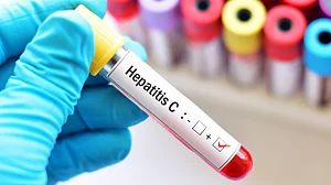 نیوزی لینڈ میں تقریباً 45 ہزار افراد ہیپاٹائٹس- سی مرض سے متاثر
