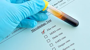 اتر پردیش میں کورونا کے ساتھ ایک نئی آفت کا قہر، سبھی اسپتال الرٹ پر