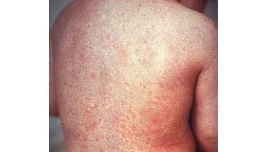 فائل علامتی تصویر آئی اے این ایس