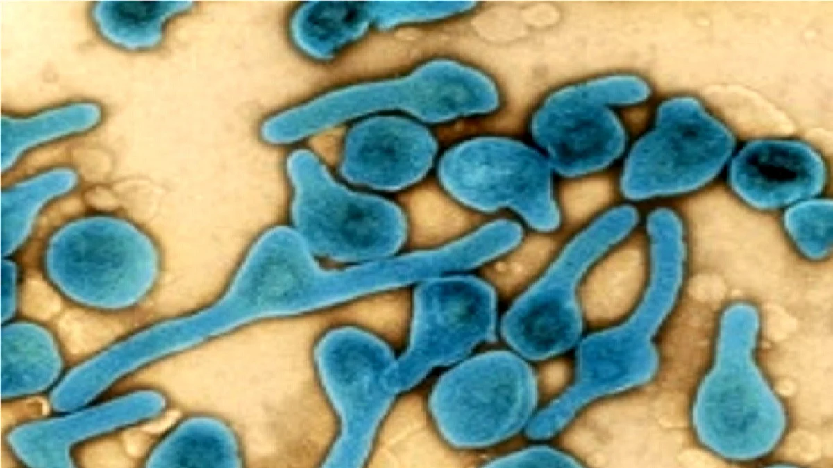 <div class="paragraphs"><p>وائرس کی علامتی تصویر، آئی اے این ایس</p></div>