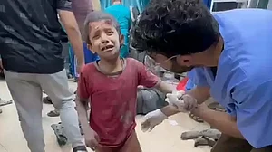 غزہ میں شدید انسانی بحران، غذائی قلت کے شکار بچوں سے بھرے اسپتال