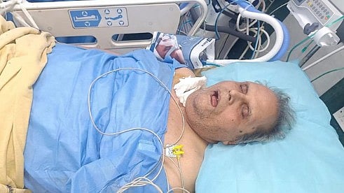 ستیہ پال ملک کے دونوں گردے فیل، ان کے قریبی نے تصدیق کی