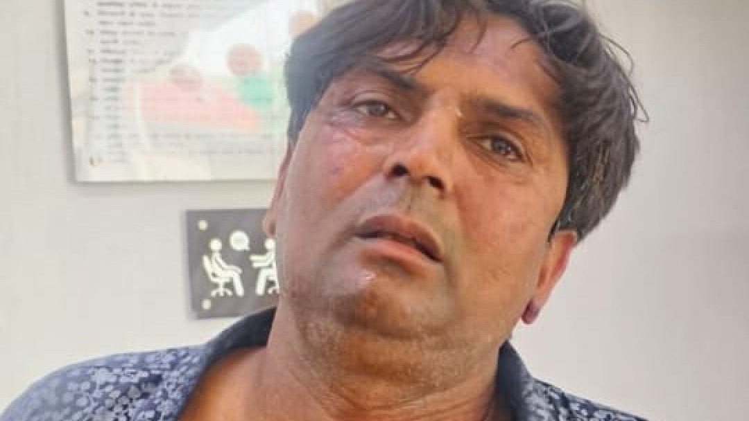 <div class="paragraphs"><p>وزیر اعلیٰ ریکھا گپتا کو تھپڑ مارنے والا ملزم، تصویر سوشل میڈیا</p></div>