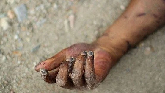 <div class="paragraphs"><p>فائل تصویر یو این آئی</p></div>