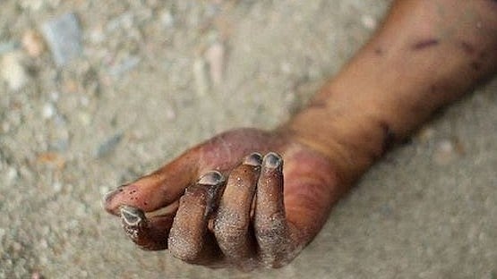 <div class="paragraphs"><p>فائل تصویر یو این آئی</p></div>