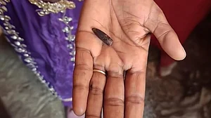 ہریانہ میں سامنے آیا حیرت انگیز واقعہ، 12 برس کی عمر میں لگی گولی 32 سال بعد بھی جسم میں موجود