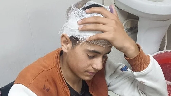 <div class="paragraphs"><p>زخمی کشمیری لڑکا تابش، تصویر&nbsp;<a href="https://x.com/INCIndia">@INCIndia</a></p></div>