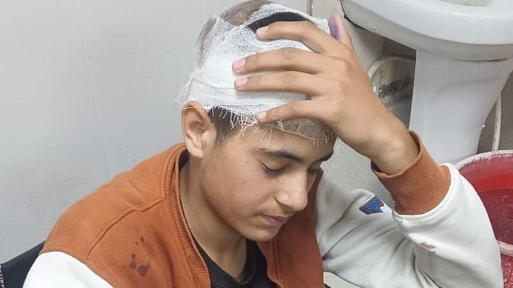 <div class="paragraphs"><p>زخمی کشمیری لڑکا تابش، تصویر <a href="https://x.com/INCIndia">@INCIndia</a></p></div>