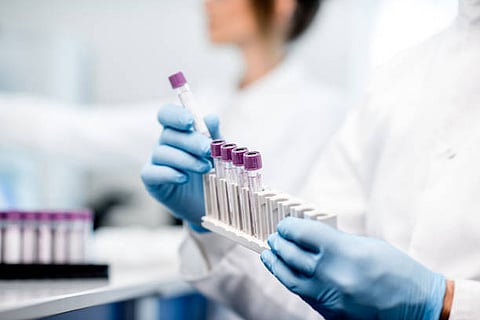Why Use ICP-MS? Advantages and Applications in Modern Science