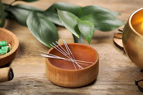 5 Essential Features to Check When You Buy Acupuncture Needles Online