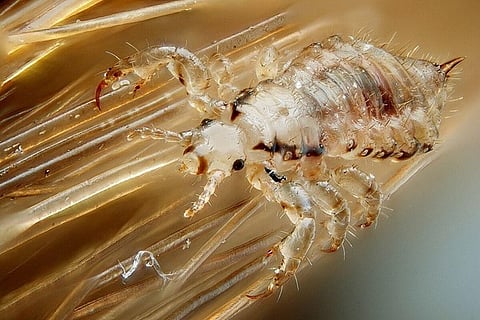 Head Lice Myths Busted: What Parents Really Need to Know