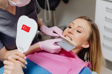Best Veneers Packages in Turkey: Top Deals Compared