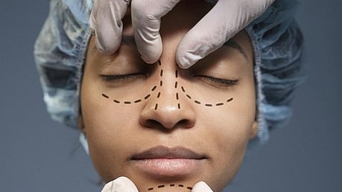 Face with surgical markings and gloved hands preparing for rhinoplasty procedure