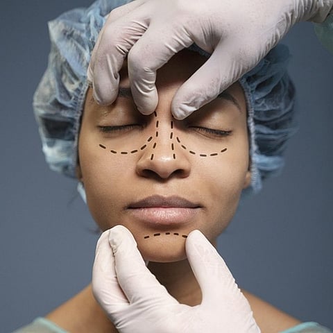 Types of Rhinoplasty Based on Nose Shape