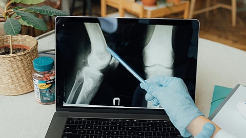 a medical professional reviewing a digital X-ray of a knee joint on a laptop screen