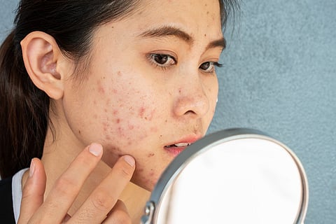red, raised bumps and inflammatory lesions on the cheek
