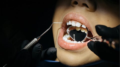 Fredrik  Reinfeldts tandvårdsrabatt för asylsökande tas bort