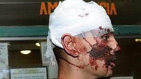 MAĎARSKO: USA oceňujú postoj vlády k situácii Rómov v Gyöngyöspate.