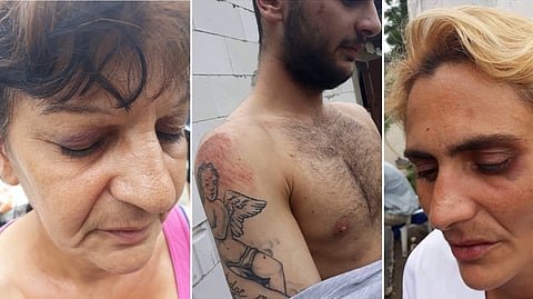 Rómky uspeli v Štrasburgu: Slovensko musí platiť za policajné násilie