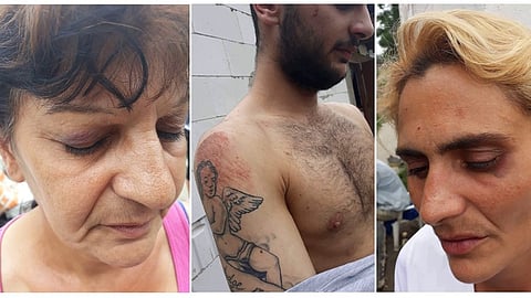 Rómky uspeli v Štrasburgu: Slovensko musí platiť za policajné násilie