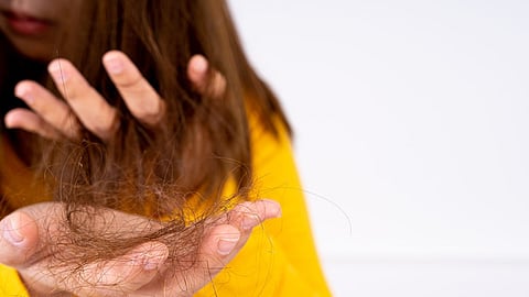 Hair loss, Vitamins problem, Hair falls, how to stop hair fall immediately, Hair fall causes, 