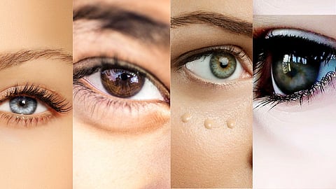 Eye Color 
