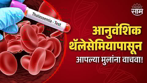 Thalassemia 