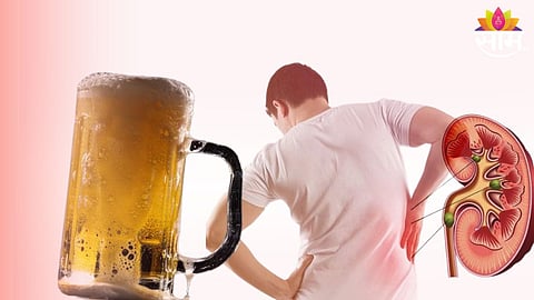 Kidney Stone, Health Tips