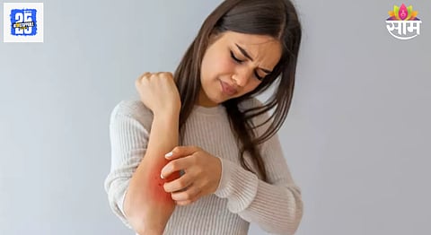 Skin allergy: किती आहेत त्वचेच्या अ‍ॅलर्जीचे प्रकार? जाणून घ्या परिणाम आणि घरगुती उपचार