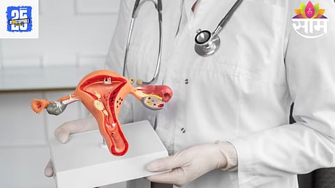 PCOS Tips