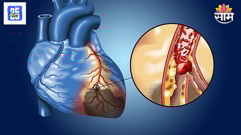 Swelling in heart causes and treatment