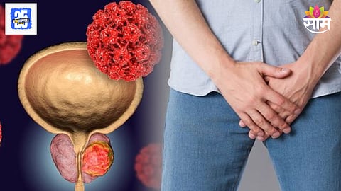 Prostate cancer symptoms