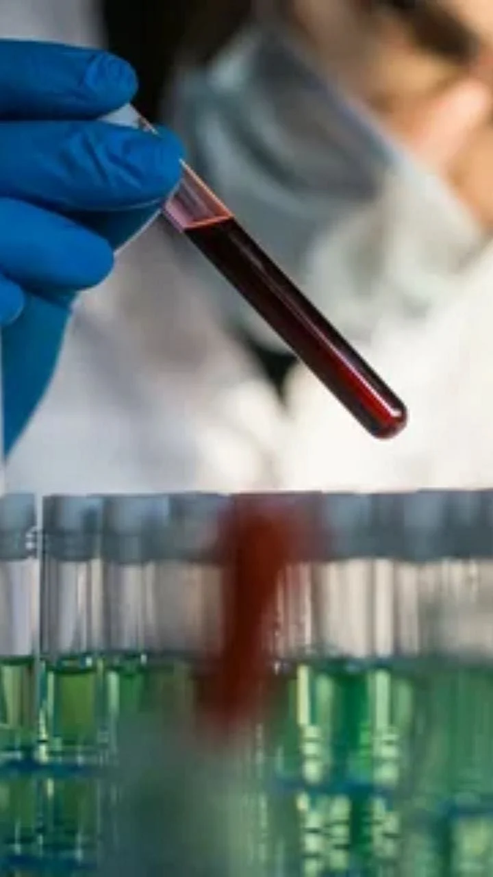 Cancer Test
