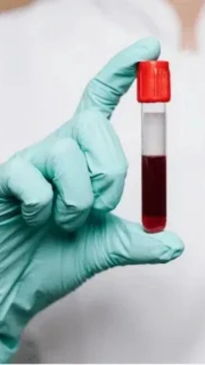 Cancer Test