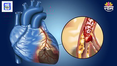 Inflamed heart symptoms