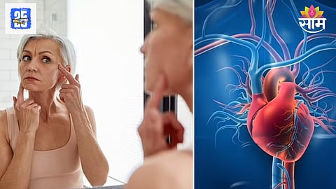 Heart attack face symptoms