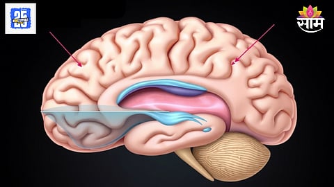 Brain water accumulation symptoms