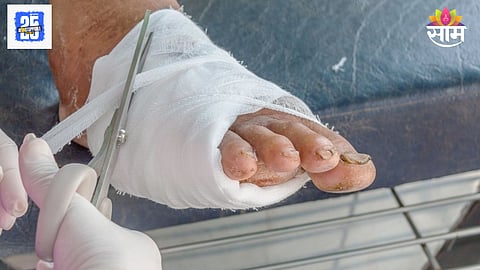 Foot gangrene symptoms