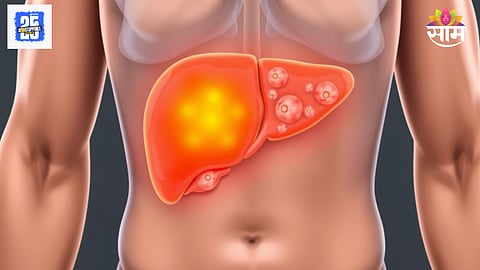 Liver cancer early symptoms