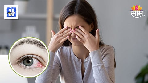  Eye Care