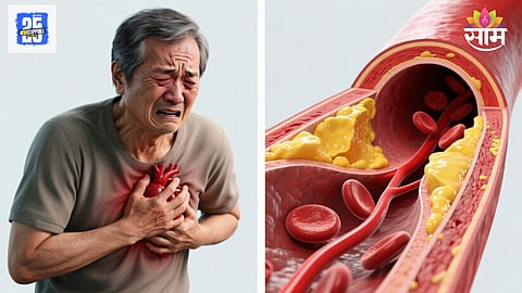 Symptoms of bad cholesterol