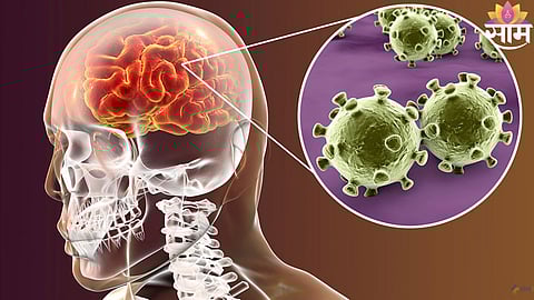 Meningitis Symptoms